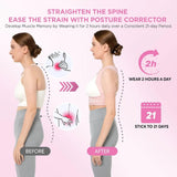 Vicorrect Posture Corrector for Women / Size S-M